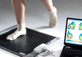 Hallux valgus diagnostikoa