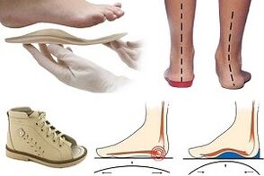 ume baten hallux valgus oinetako ortopedikoak