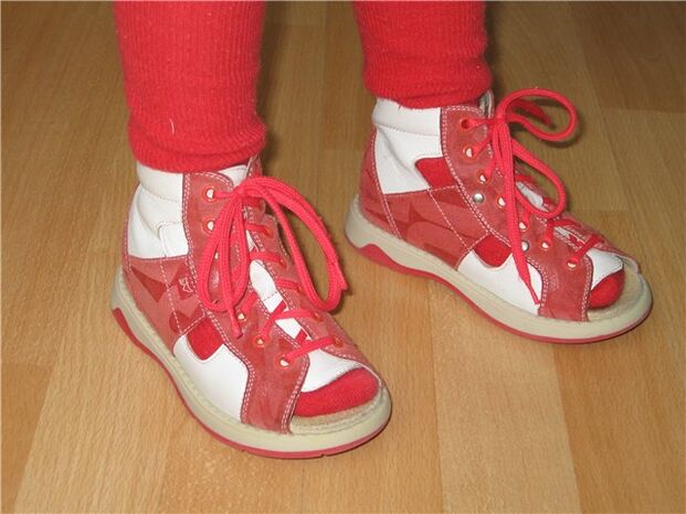 hallux valgus duten haurrentzako oinetakoak