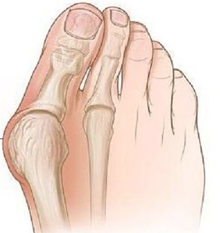 Thumb-en koadrila
